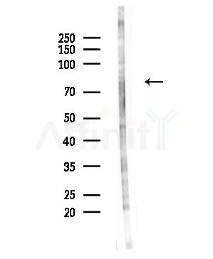 Phospho-p70 S6 Kinase (Thr389/Thr412) Antibody - Western blot analysis of lysates from Hela cells(UV,30min treatment), using Phospho-p70 S6 Kinase (Thr389/Thr412) Antibody at 1/1000 dilution.