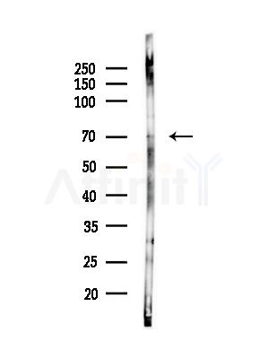 Phospho-p70 S6 Kinase (Ser424)[Ser447] Antibody - Western blot analysis of lysates from PC12 cells(starvation,24h treatment), using Phospho-p70 S6 Kinase (Ser424)[Ser447] Antibody at 1/1000 dilution.