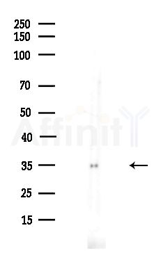 Phospho-CDK1/CDC2 (Thr14) Antibody - Western blot analysis of lysates from A375 cells(LPS,4h treatment), using Phospho-CDK1/CDC2 (Thr14) Antibody at 1/1000 dilution.