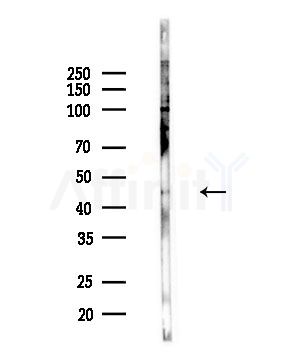 Phospho-CXCR2 (Ser347) Antibody - Western blot analysis of lysates from PC12 cells(LPS,4h treatment), using Phospho-CXCR2 (Ser347) Antibody at 1/1000 dilution.