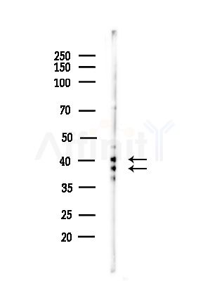 Phospho-ERK1/2 (Thr202) Antibody - Western blot analysis of lysates from PC12 cells(starvation,24h treatment), using Phospho-ERK1/2 (Thr202) Antibody at 1/1000 dilution.