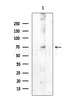 Phospho-PI3K p85 (Tyr458)[Tyr467]/p55 (Tyr199) Antibody - Western blot analysis of extracts from COLO205 cells, using Phospho-PI3K p85 (Tyr458)[Tyr467]/p55 (Tyr199) Antibody at 1/1000 dilution.