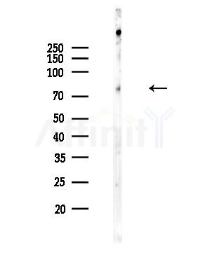 Phospho-PI3K p85 (Tyr458)[Tyr467]/p55 (Tyr199) Antibody - Western blot analysis of lysates from COLO205 cells, using Phospho-PI3K p85 (Tyr458)[Tyr467]/p55 (Tyr199) Antibody at 1/1000 dilution.