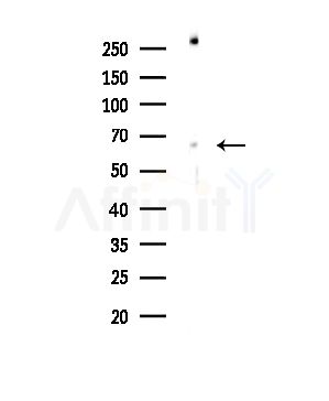 Phospho-SHP1 (Tyr536) Antibody - Western blot analysis of lysates from COLO205 cells, using Phospho-SHP1 (Tyr536) Antibody at 1/1000 dilution.