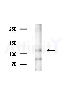 Phospho-eNOS (Thr495) Antibody - Western blot analysis of extracts from EC304 cells(heat-shock,45min treatment), using Phospho-eNOS (Thr495) Antibody at 1/1000 dilution.
