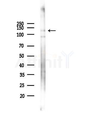 Phospho-eNOS (Thr495) Antibody - Western blot analysis of lysates from EC304 cells(heat-shock,45min treatment), using Phospho-eNOS (Thr495) Antibody at 1/1000 dilution.