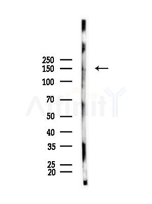 Phospho-nNOS (Ser852) Antibody - Western blot analysis of lysates from Mouse muscle, using Phospho-nNOS (Ser852) Antibody at 1/1000 dilution.