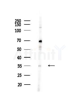 Phospho-MARCKS (Ser159) Antibody - Western blot analysis of lysates from RAW264.
