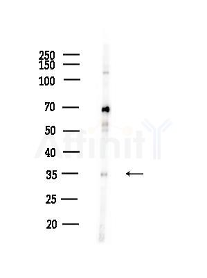 Phospho-MARCKS (Ser159) Antibody - Western blot analysis of lysates from RAW264.