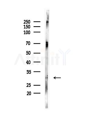 Phospho-Cyclin D3 (Thr283) Antibody - Western blot analysis of lysates from PC12 cells(starvation,24h treatment), using Phospho-Cyclin D3 (Thr283) Antibody at 1/1000 dilution.