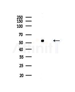 Phospho-CDC25A (Ser124) Antibody - Western blot analysis of lysates from COLO205 cells, using Phospho-CDC25A (Ser124) Antibody at 1/1000 dilution.