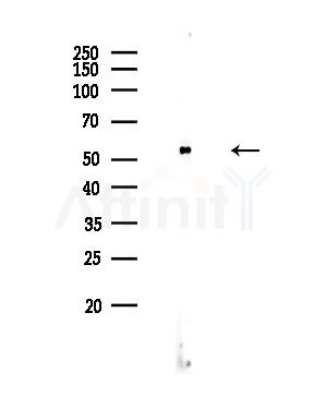 Phospho-CDC25A (Ser124) Antibody - Western blot analysis of lysates from HUVEC cells, using Phospho-CDC25A (Ser124) Antibody at 1/1000 dilution.