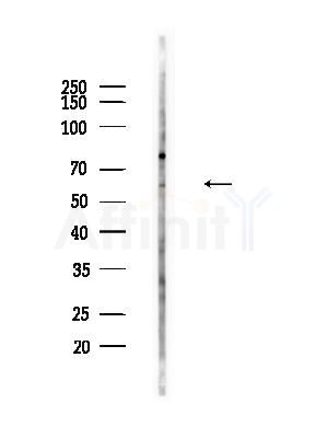 Phospho-CDC25A (Thr507) Antibody - Western blot analysis of lysates from B16F10-LUC cells(heat-shock,45min treatment), using Phospho-CDC25A (Thr507) Antibody at 1/1000 dilution.