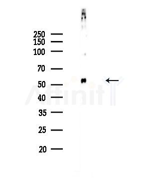 Phospho-CDC25C (Ser216) Antibody - Western blot analysis of lysates from COLO205 cells, using Phospho-CDC25C (Ser216) Antibody at 1/1000 dilution.