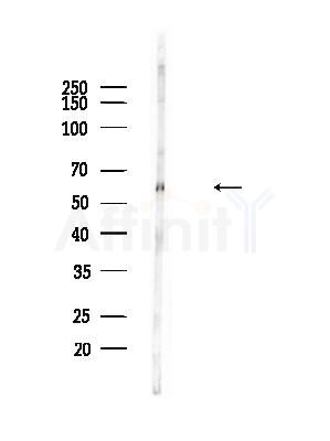Phospho-AKT1 (Thr450) Antibody - Western blot analysis of lysates from B16F10-LUC cells(heat-shock,45min treatment), using Phospho-AKT1 (Thr450) Antibody at 1/1000 dilution.