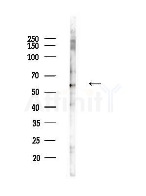Phospho-AKT1 (Thr450) Antibody - Western blot analysis of lysates from RAW264.
