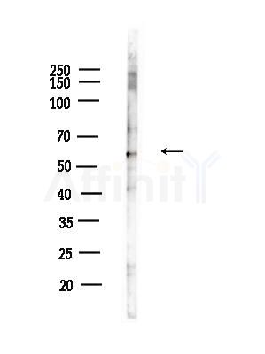 Phospho-AKT1 (Thr450) Antibody - Western blot analysis of lysates from RAW264.