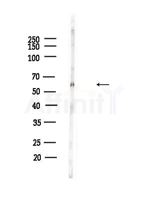 Phospho-AKT1 (Thr450) Antibody - Western blot analysis of lysates from B16F10-LUC cells(heat-shock,45min treatment), using Phospho-AKT1 (Thr450) Antibody at 1/1000 dilution.