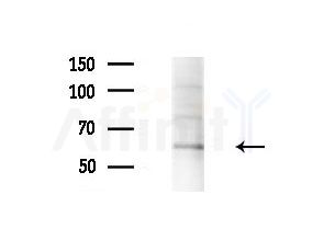 Phospho-AKT1 (Ser124) Antibody - Western blot analysis of lysates from B16F10-LUC cells(heat-shock treatment), using Phospho-AKT1 (Ser124) Antibody at 1/1000 dilution.
