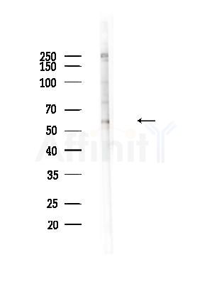 Phospho-AKT1 (Ser124) Antibody - Western blot analysis of lysates from B16F10-LUC cells(heat-shock,45min treatment), using Phospho-AKT1 (Ser124) Antibody at 1/1000 dilution.