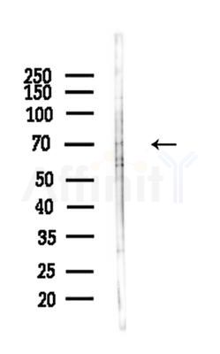 Phospho-NF2 / Merlin (Ser518) Antibody - Western blot analysis of lysates from A375 cells(heat-shock,45min treatment), using Phospho-NF2 / Merlin (Ser518) Antibody at 1/1000 dilution.