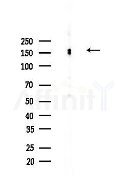 Phospho-IRS1 (Ser636) Antibody - Western blot analysis of lysates from Hela cells(heat-shock,45min treatment), using Phospho-IRS1 (Ser636) Antibody at 1/1000 dilution.
