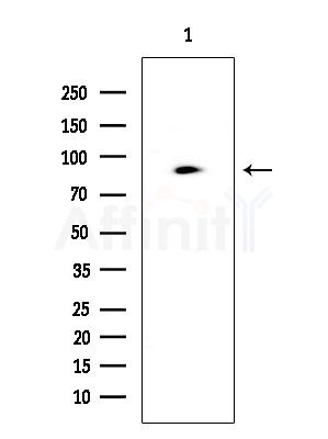 Phospho-ADD1 (Ser726) Antibody - Western blot analysis of extracts from COLO205 cells, using Phospho-ADD1 (Ser726) Antibody at 1/1000 dilution.