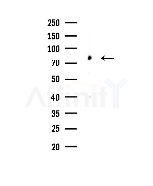 Phospho-ADD1 (Ser726) Antibody - Western blot analysis of lysates from COLO205 cells, using Phospho-ADD1 (Ser726) Antibody at 1/1000 dilution.