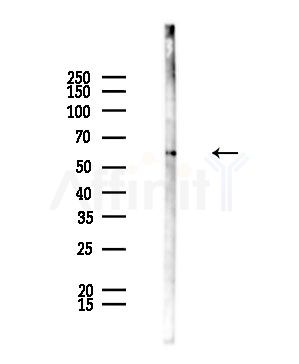 Phospho-PPAR gamma (Ser112) Antibody - Western blot analysis of lysates from Mouse testis, using Phospho-PPAR gamma (Ser112) Antibody at 1/1000 dilution.