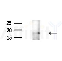Phospho-Synuclein alpha (Ser129) Antibody - Western blot analysis of extracts from COLO205 cells(heat-shock,45min treatment), using Phospho-Synuclein alpha (Ser129) Antibody at 1/1000 dilution.