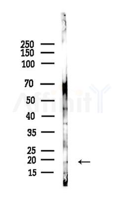 Phospho-Synuclein alpha (Ser129) Antibody - Western blot analysis of lysates from COLO205 cells(heat-shock,45min treatment), using Phospho-Synuclein alpha (Ser129) Antibody at 1/1000 dilution.