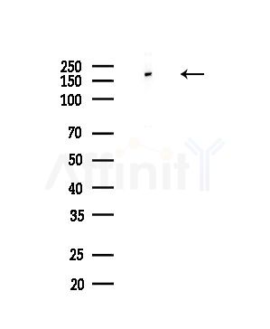 Phospho-BRCA1 (Ser1423) Antibody - Western blot analysis of lysates from PC12 cells(LPS,4h treatment), using Phospho-BRCA1 (Ser1423) Antibody at 1/1000 dilution.