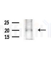 Phospho-p21 Cip1 (Thr145) Antibody - Western blot analysis of extracts from COLO205 cells(heat-shock,45min treatment), using Phospho-p21 Cip1 (Thr145) Antibody at 1/1000 dilution.