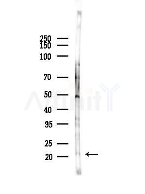 Phospho-p21 Cip1 (Thr145) Antibody - Western blot analysis of lysates from COLO205 cells(heat-shock,45min treatment), using Phospho-p21 Cip1 (Thr145) Antibody at 1/1000 dilution.