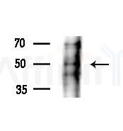 Phospho-HNF4 alpha (Ser313) Antibody - Western blot analysis of extracts from COLO205 cells(heat-shock,45min treatment), using Phospho-HNF4 alpha (Ser313) Antibody at 1/1000 dilution.
