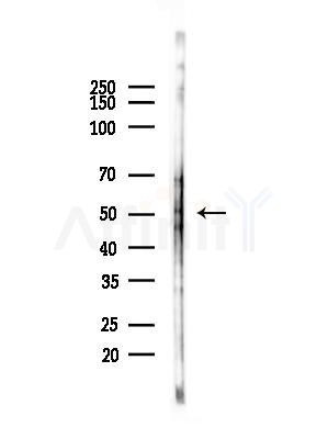 Phospho-HNF4 alpha (Ser313) Antibody - Western blot analysis of lysates from COLO205 cells(heat-shock,45min treatment), using Phospho-HNF4 alpha (Ser313) Antibody at 1/1000 dilution.