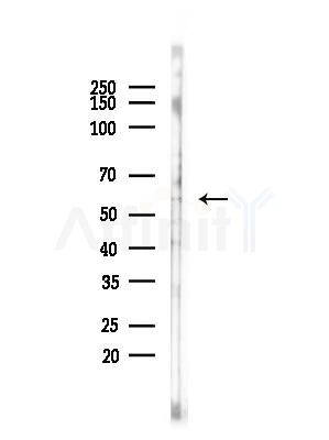 Phospho-MAP3K8/COT (Thr290) Antibody - Western blot analysis of lysates from COLO205 cells(heat-shock,45min treatment), using Phospho-MAP3K8/COT (Thr290) Antibody at 1/1000 dilution.