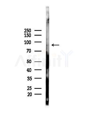Phospho-STAT6 (Thr645) Antibody - Western blot analysis of lysates from Mouse liver, using Phospho-STAT6 (Thr645) Antibody at 1/1000 dilution.