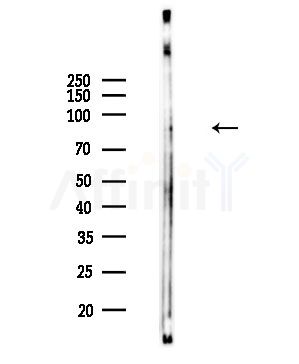 Phospho-STAT5A (Ser780) Antibody - Western blot analysis of lysates from COLO205 cells, using Phospho-STAT5A (Ser780) Antibody at 1/1000 dilution.