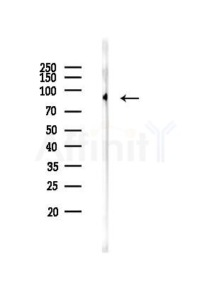 Phospho-STAT5 (Tyr694) Antibody - Western blot analysis of lysates from HUVEC cells, using Phospho-STAT5 (Tyr694) Antibody at 1/1000 dilution.