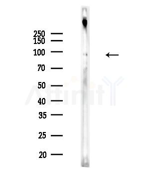 Phospho-GluR2 (Ser880) Antibody - Western blot analysis of lysates from Rat brain, using Phospho-GluR2 (Ser880) Antibody at 1/1000 dilution.