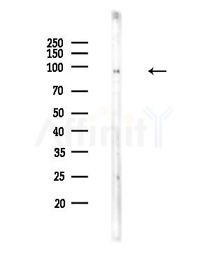 Phospho-GluR2 (Ser880) Antibody - Western blot analysis of lysates from COLO205 cells, using Phospho-GluR2 (Ser880) Antibody at 1/1000 dilution.