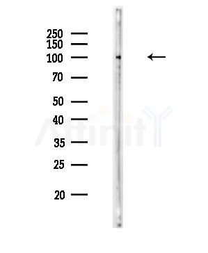 Phospho-GluR2 (Ser880) Antibody - Western blot analysis of lysates from HUVEC cells, using Phospho-GluR2 (Ser880) Antibody at 1/1000 dilution.