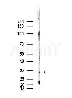 Phospho-Caspase 3 (Ser150) Antibody - Western blot analysis of lysates from Raji cells(heat-shock,45min treatment), using Phospho-Caspase 3 (Ser150) Antibody at 1/1000 dilution.