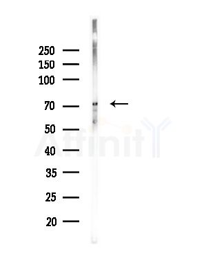 Phospho-SYK (Tyr348) Antibody - Western blot analysis of lysates from Rat brain, using Phospho-SYK (Tyr348) Antibody at 1/1000 dilution.