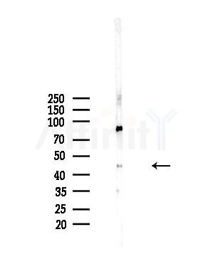 Phospho-JNK1/2/3 (Thr183+Tyr185) Antibody - Western blot analysis of lysates from A375 cells(starvation,24h treatment), using Phospho-JNK1/2/3 (Thr183+Tyr185) Antibody at 1/1000 dilution.