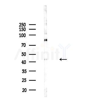 Phospho-JNK1/2/3 (Thr183+Tyr185) Antibody - Western blot analysis of lysates from HepG2 cells(LPS,4h treatment), using Phospho-JNK1/2/3 (Thr183+Tyr185) Antibody at 1/1000 dilution.
