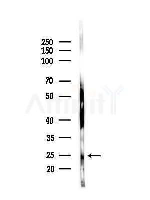 Phospho-p27 Kip1 (Thr187) Antibody - Western blot analysis of lysates from HepG2 cells(heat-shock,45min treatment), using Phospho-p27 Kip1 (Thr187) Antibody at 1/1000 dilution.