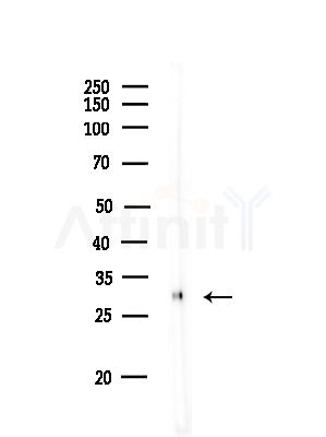 Phospho-p27 Kip1 (Thr198) Antibody - Western blot analysis of lysates from Rat lung, using Phospho-p27 Kip1 (Thr198) Antibody at 1/1000 dilution.