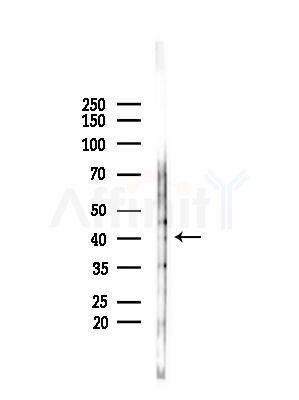 Phospho-MKK3 (Ser189) Antibody - Western blot analysis of lysates from COLO205 cells(heat-shock,45min treatment), using Phospho-MKK3 (Ser189) Antibody at 1/1000 dilution.